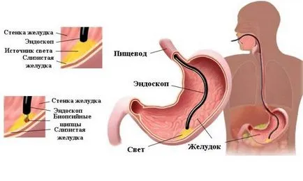 Mi jobb EGD vagy ultrahang a gyomor - előnyeit és hátrányait a különböző diagnosztikai módszerek