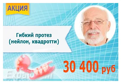 Diastemă și trei motive și costul tratamentului, la un cost redus în clinica ortodonție eksamed