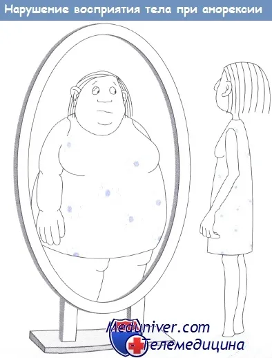 Anorexia nervoasa - tablou clinic, diagnostic, tratament