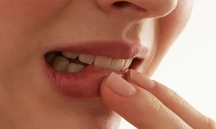 Fényképeket a periodontitis tünetei