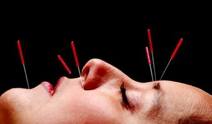 Acupunctura și contraindicații