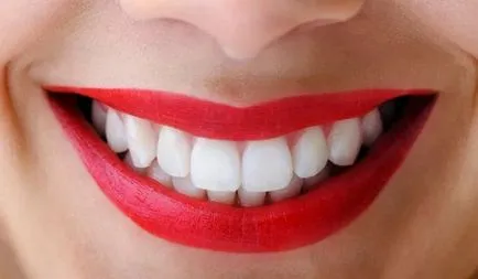 Как безопасно да избелите зъбите си у дома метод производители на Colgate