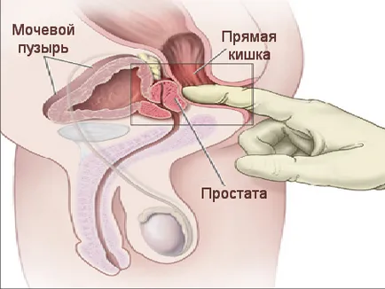 Cum sa faci propriul tehnica de masaj de prostata de auto-masaj - portalul urologic №1