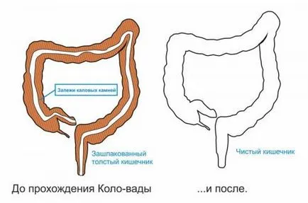 Как правилно и безопасно да отслабнете без да се връща