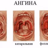 Картофи - какво е значението на тези знаци - народни предзнаменования