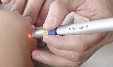 Molluscum contagiosum simptomelor copiilor și tratamente, îndepărtarea cu laser pe fața copilului