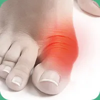 Cumpara hallux valgus (valgus pro) de blocare de autobuz valg în magazin oficial