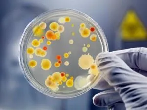 Proprietăți bacterii culturale metode pe mediu solid sau lichid de învățare