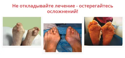 Cumpara hallux valgus (valgus pro) de blocare de autobuz valg în magazin oficial