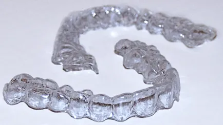 Orthosnap - възможност за ново поколение aligners