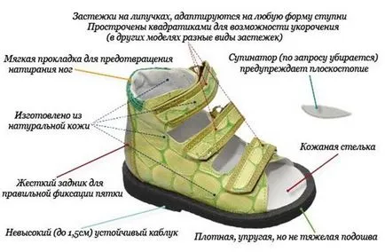 Alapvető követelmény az ortopéd cipők