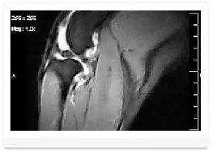 Mágneses rezonancia képalkotás (MRI) az állatok számára