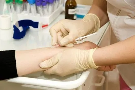 contraindicații vaccin Mantoux