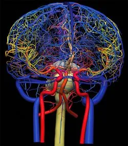 angiografie cerebrală RMN, vasele de sange, artere