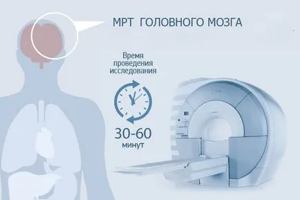 MRI на мозъчните артерии - което трябва да знаете