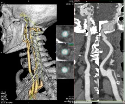 MRI az agy artériák - meg kell tudni