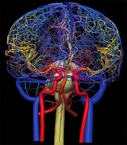 RMN a arterelor cerebrale - trebuie să știți