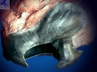 Octopus - clasificarea speciilor și structura corpului