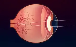 Din față și din spate, neuropatie optică ischemică - cauze, simptome, un tratament eficient