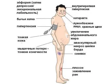 Намаляване на кръвната захар симптоми, причини, ниски нива на глюкоза в жени