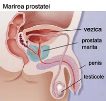 Причини за Trichomonas простатит и особено нейното лечение