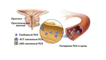 Причини за Trichomonas простатит и особено нейното лечение