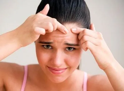 Spoturi după acnee, cum să scapi de pete după acnee