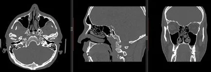 X-ray tomografie computerizata, Institutul de Pediatrie