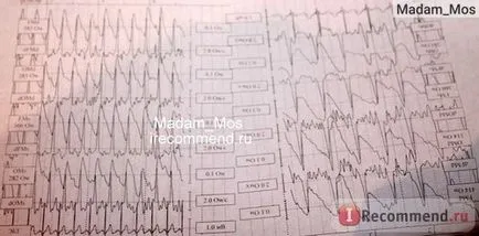 Rheoencephalography (REG) - „rheoencephalography sau reggae - ceea ce este și ceea ce cap de cercetare