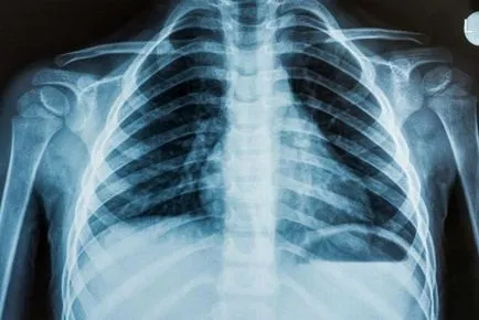 Röntgenkép eljárás leírása, dekódolás és ajánlások
