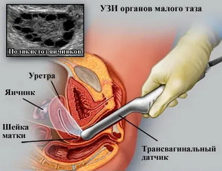 Készíts egy kismedencei ultrahang Moszkvában