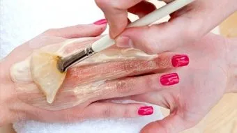 Peeling az ujjak között - az okok és a lehetséges kezelések