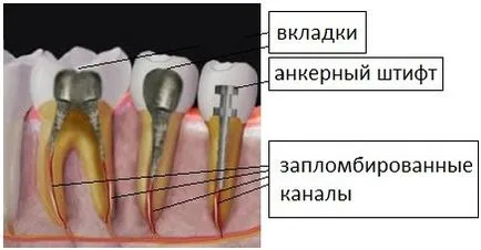 Pins и протези, клиника Dobryninskaya