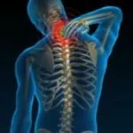 Scolioza a coloanei vertebrale, exerciții de tratament, simptomele