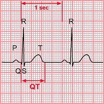 QT синдром продълговатия жлеб предизвиква удължаване на QT наркотици