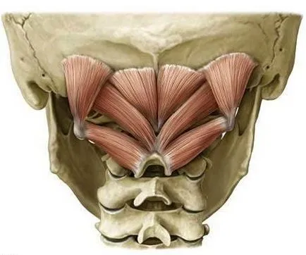 mușchii oblici inferioare ale sindromului capului