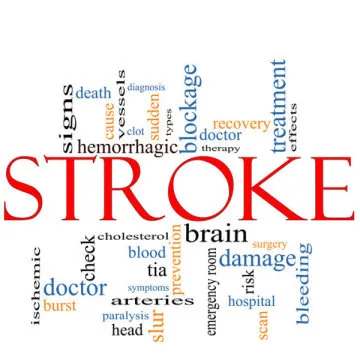 Hypnotic segít visszaállítani az agy stroke után