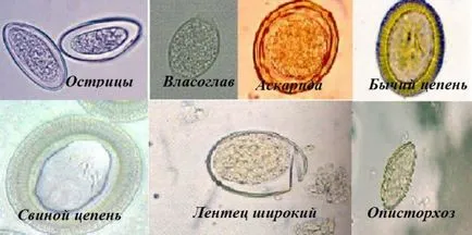 Колко яйца на червеи живеят извън човешкото тяло