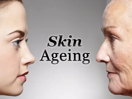 Aging Skin - okai, tünetei, diagnózisa és kezelése