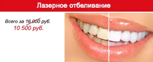Clinica stomatologică în Nijni Novgorod, sisteme de aparate dentare