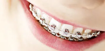 Dentistry maxi-dent - tratament dentar, implanturi, bretele, tratament guma in Hasavyurt