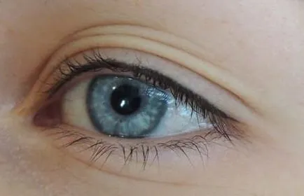 Eye tattoo nyilak fotók előtt és után az eljárás technológiai