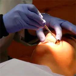 ratele de implantare transgingivală in Bucuresti
