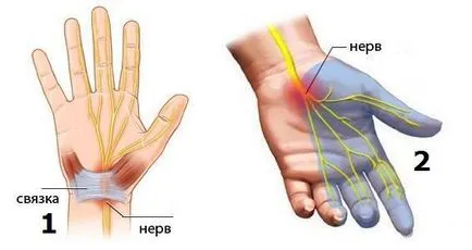 синдром на тунела, когато става хора 