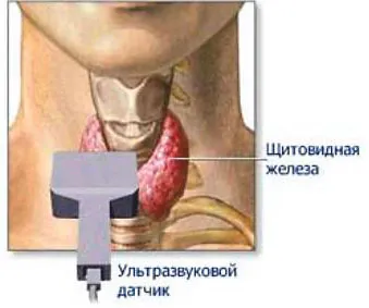 Щитовидната ултразвук в Люблин