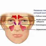 Polisinusit какво е, симптоми и лечение