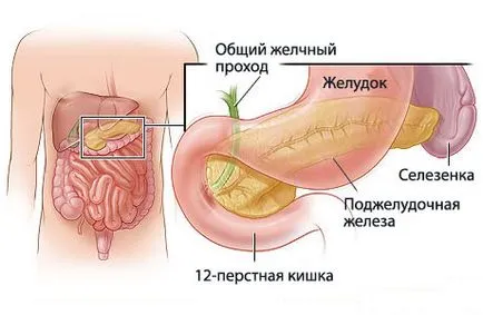 pancreatită cronică la copii - simptome, prevenirea și tratamentul pancreatitei cronice