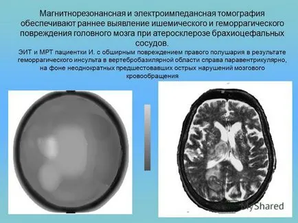 Prezentare pe tomografie impedanței electrice