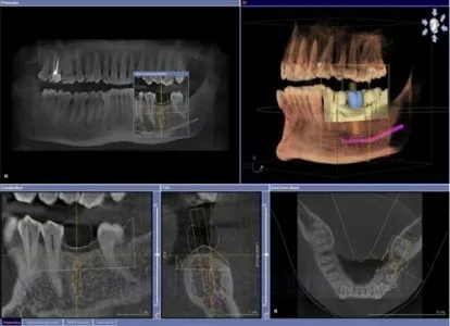 3D-x-sugarak, a fogak, amely megmutatja, hogy miért és hogyan kell csinálni