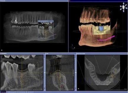 3D-x-sugarak, a fogak, amely megmutatja, hogy miért és hogyan kell csinálni